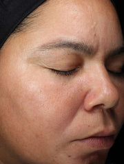 Image of face after using product